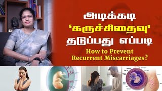 Recurrent miscarriage How to prevent [upl. by Ahsael]