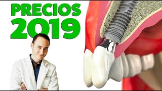 Implantes Dentales PRECIOS 2019 ¿Subirán de precio este año [upl. by Mildred729]