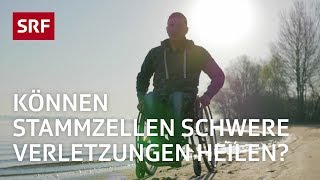 Stammzellen Ein Wundermittel der Medizin  Erklärvideo  SRF [upl. by Evelinn]