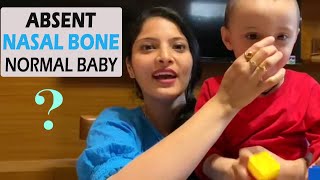 Absent Nasal Bone Normal Baby जानिए अब आगे क्या  NT Scan Details in Hindi [upl. by Massiw556]