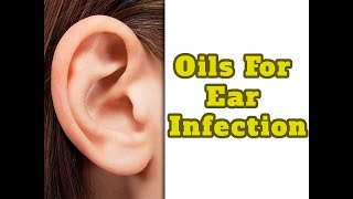 10 Best Essential Oils For Ear Infection  Boldsky [upl. by Netsuj]