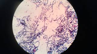 Bacillus species under the Microscope [upl. by Tildy]