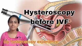 Hysteroscopy before IVF treatmentHysteroscopy surgery procedure cost importanceMy experience [upl. by Ahsein228]