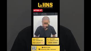 Hair transplant clinic in coimbatore  LaHNS  Coimbatore [upl. by Glaudia]