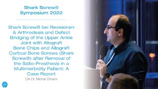 OA Dr Michel Chraim  OSG Arthrodese mit Shark Screw [upl. by Carrick]