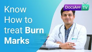 How to treat Burn Marks on the Skin Skin Treatment AsktheDoctor [upl. by Ailisec]