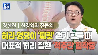 건강앤한경 중장년 허리통증 주범ㅣ허리·엉덩이 ‘찌릿’ 걷기 힘들 때ㅣ걷다 쉬다를 반복해야 한다 [upl. by Eras451]