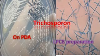 Trichosporon on SDA and LPCB preparation under the microscope [upl. by Ialocin568]