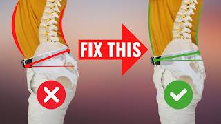 FIX Anterior Pelvic Tilt in 100 Seconds for PERFECT Posture [upl. by Nyberg214]