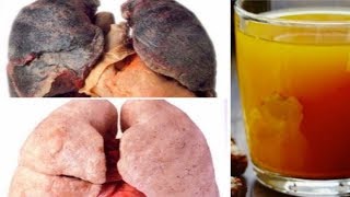 धुम्रपान से खराब हो चुके फेफड़ों को साफ़ करने का प्राकृतिक इलाज़ This Drink Will Cleanse Your Lungs [upl. by Livesay]