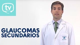 Los glaucomas secundarios [upl. by Tomlinson13]