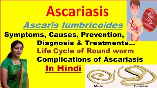 Ascariasis  Ascaris Lumbricoides  Symptoms Causes Diagnosis Treatment  Roundworm life cycle [upl. by Pownall]