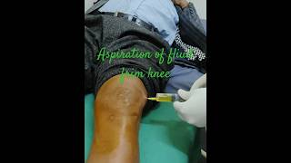 Knee joint aspiration  swollen knee due to prp injection💉🩺🏥orthopedics kneeinjection kneepain [upl. by Acinnad]