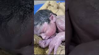 Vernix caseosaknown as vernix is the waxy white substance found coating the skin newborn human baby [upl. by Akili270]