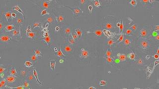 Essen BioScience CellPlayer Kinetic Cytotoxicity Assay [upl. by Corina]