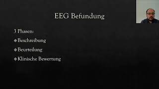 EEG einfach erklärt  Teil 6 EEGBefundung [upl. by Mode]