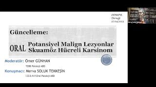 ODMFR Oral Potansiyel Malign Lezyonlar Oral Skuamöz Hücreli Karsinom [upl. by Salkcin]