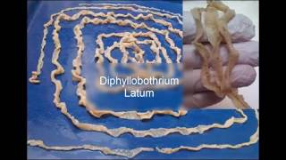 Diphyllobothrium latum [upl. by Deloria630]