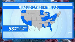 CDC urges vaccination amid rise in measles cases in the US and globally [upl. by Naej]