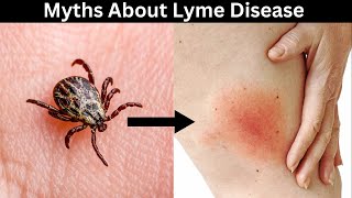 Top 10 Myths About Lyme Disease Debunked [upl. by Hedberg]