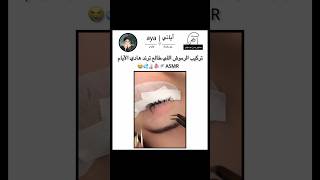 أسمر عناية كاملة skin care asmrasmrsleep asmrfood music asmrsounds asmrvideo بدون موسيقى [upl. by Suehtomit559]