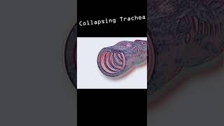 Collapsing Trachea in dogs shorts [upl. by Netsirhc941]