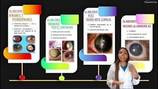 SUBGRUPO 15  GLAUCOMAS SECUNDARIOS Y GLAUCOMA CONGENITO E INFANTIL [upl. by Sibeal]