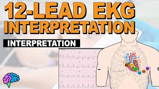 The SIMPLE Steps of 12Lead EKG Interpretation  EXPLAINED CLEARLY [upl. by Wainwright]