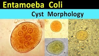 Entamoeba Coli Cyst Morphology [upl. by Nyrb]