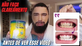 COMO FAZER CLAREAMENTO DENTAL CASEIRO COM LEITE EM PÓ E SMILINE [upl. by Alyam466]