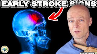 10 Warnings Signs Of STROKE A Week BEFORE It Happens [upl. by Doykos]