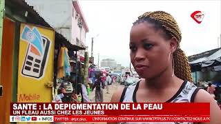 SANTÉ  LA DÉPIGMENTATION DE LA PEAU UN FLÉAU AUSSI CHEZ LES JEUNES [upl. by Alake]