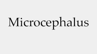 How to Pronounce Microcephalus [upl. by Korfonta]