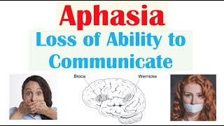 Aphasia  Types Broca’s Wernicke’s Global Causes Signs amp Symptoms Diagnosis Treatment [upl. by Eeralav]