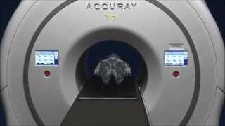 Accuray® TomoTherapy® H™ Series [upl. by Gris67]