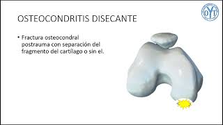 OSTEOCONDRITIS DISECANTE [upl. by Ahsienauq]