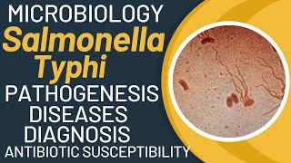 Salmonella typhi microbiology  Typhoid fever pathogenesis by salmonella typhimurium [upl. by Gunnar]