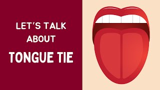 Part I  Tongue Tie  Tongue Therapy  Tongue Posture  Tongue Exercises [upl. by Monahon]