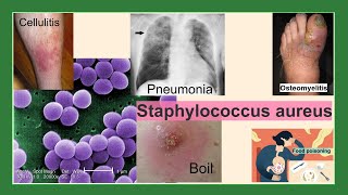 Staphylococcus aureus [upl. by Grange]