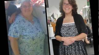 HCG Diet Before and After Weight Loss [upl. by Aisela810]