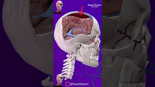 Subdural Hematoma  🧠🩸 [upl. by Artemed757]