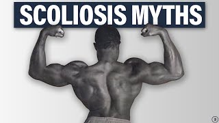 5 Facts You NEED to Know About Scoliosis Best Exercises Back Pain Performance and More [upl. by Niak]