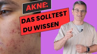 Umfassender Ratgeber zur AkneBehandlung Tipps amp Therapien von Dr Kasten akne aknebehandlung [upl. by Nhguavoj]