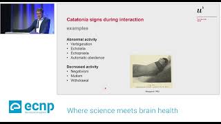 Catatonia aetiology presentation assessment and treatment 2392024 [upl. by Seebeck]