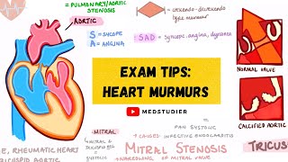 Aortic Stenosis  Heart Sounds  MEDZCOOL [upl. by Bodkin]