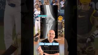 Little Leaguer’s Elbow ⚾️ Big League Elbow Pain shorts [upl. by Narah117]