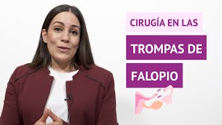 ¿La cirugía soluciona los problemas en las trompas de Falopio [upl. by Prosser]