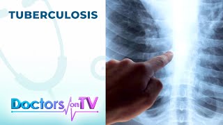 TUBERCULOSIS Symptoms and Treatment  DOTV [upl. by Bernice830]