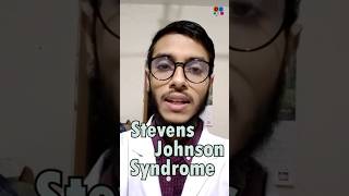 Stevens Johnson Syndrome  Sulfonamide  Penicillin  Antibiotics  Adverse effects [upl. by Arlena]