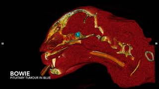 Pituitary gland tumour CT 3D Reconstruction  The first successful hypophysectomy in Australia [upl. by Leandro]